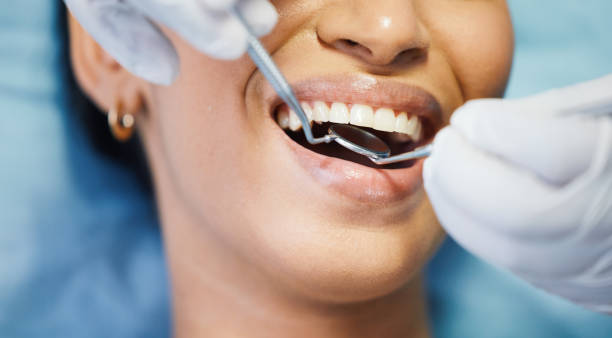 Best Emergency Treatment for Oral Infections in Petal, MS