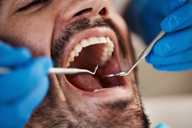 Best Broken or Chipped Tooth Repair in Petal, MS